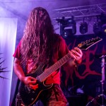 0367 Analepsy